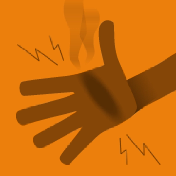 02 medicazione approfondimenti ustioni 185x185
